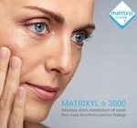 Matrixyl ® 3000