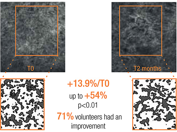 Fiber network reconstruction under confocal microscopy